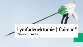 Rozšířená ilio-obturatis lymfadenektomie