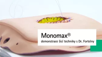 Monomax® chirurgické šití Aesculap