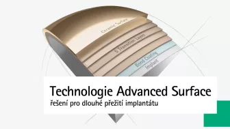 Technologie Advanced Surface | Řešení pro dlouhé přežití implantátu