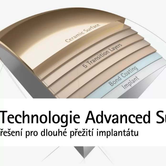 Technologie Advanced Surface | Řešení pro dlouhé přežití implantátu